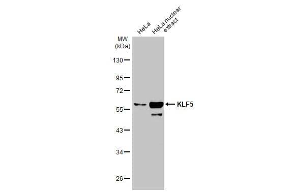 KLF5 Antibody - BSA Free