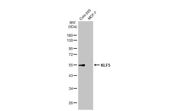 KLF5 Antibody - BSA Free