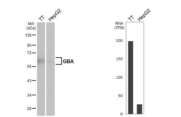 Glucosylceramidase/GBA Antibody - BSA Free