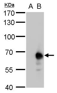 PKLR Antibody