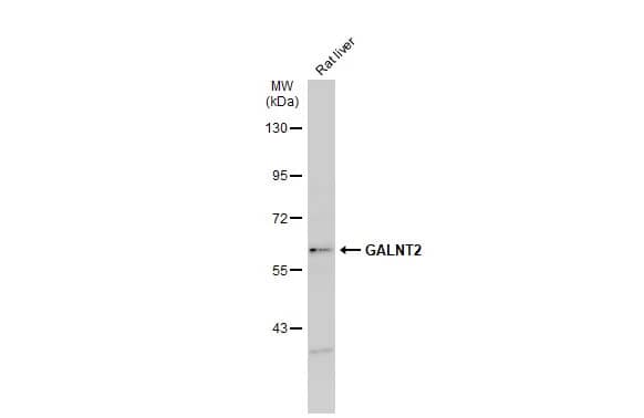 GALNT2 Antibody