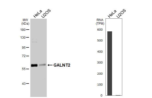 GALNT2 Antibody - BSA Free