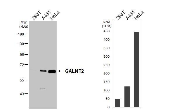 GALNT2 Antibody - BSA Free