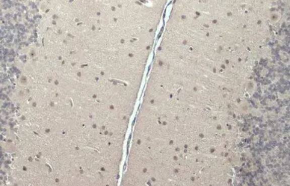 CSB Antibody