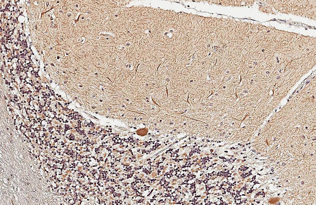 ST3 beta-Gal alpha-2,3-Sialyltransferase 2/ST3GAL2 Antibody - BSA Free