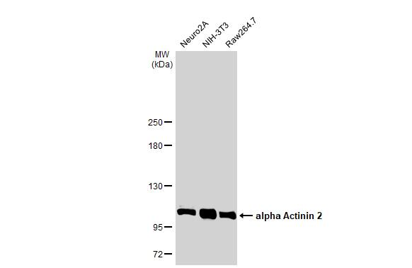 Alpha Actinin 2 Antibody