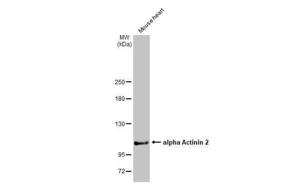 Alpha Actinin 2 Antibody