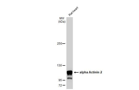 Alpha Actinin 2 Antibody