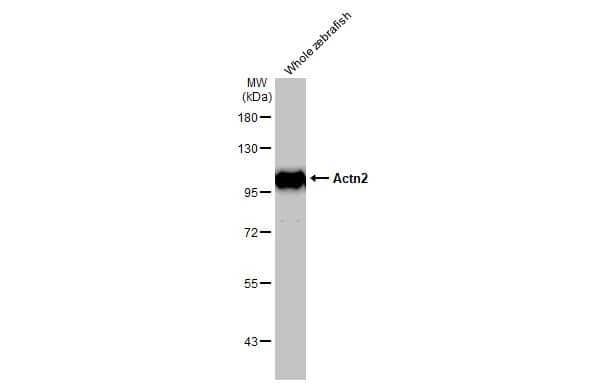 Alpha Actinin 2 Antibody