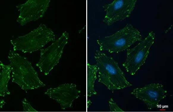 Alpha Actinin 2 Antibody