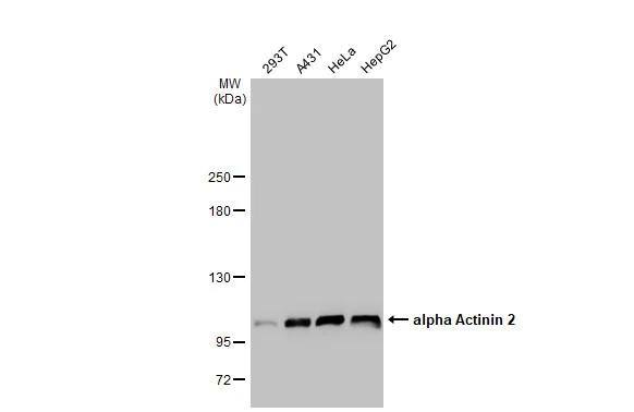 Alpha Actinin 2 Antibody