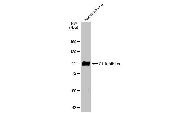 Serpin G1/C1 Inhibitor Antibody