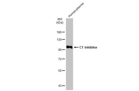 Serpin G1/C1 Inhibitor Antibody