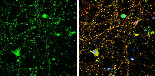 Amphiphysin/AMPH Antibody
