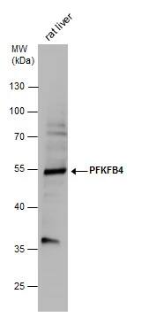 PFKFB4 Antibody