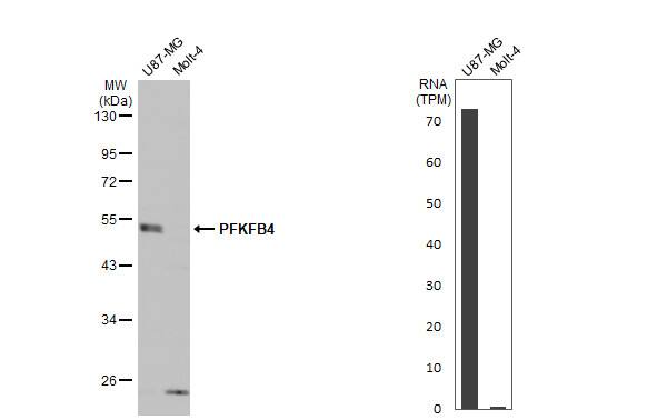 PFKFB4 Antibody - BSA Free
