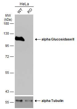 alpha Glucosidase 2 Antibody - BSA Free
