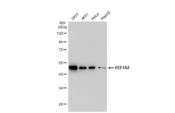 EEF1A2 Antibody