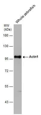 alpha-Actinin 1 Antibody