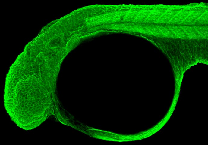alpha-Actinin 1 Antibody