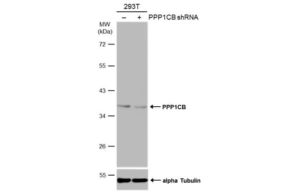 Protein Phosphatase 1 beta Antibody