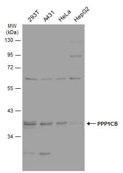 Protein Phosphatase 1 beta Antibody