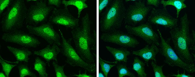 Protein Phosphatase 1 beta Antibody