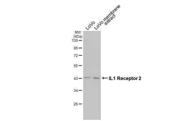 IL-1 RII Antibody - BSA Free