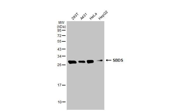 Ribosome maturation protein SBDS Antibody - BSA Free
