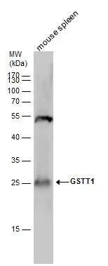 GSTT1 Antibody
