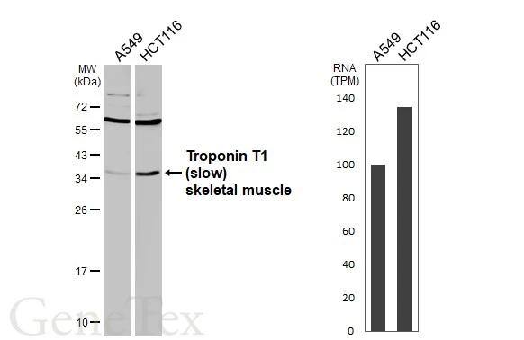 Troponin T type 1 (slow skeletal) Antibody - BSA Free