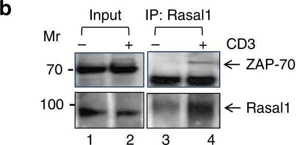 RASAL1 Antibody