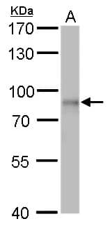 DDX3 Antibody