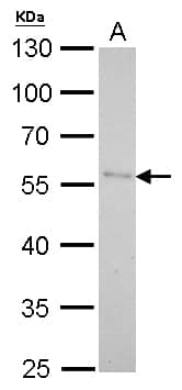 Pancreatic Lipase Antibody