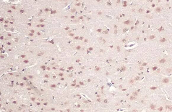 O-GlcNAc Transferase p110 subunit Antibody
