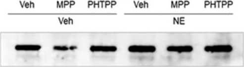 Glycogen Phosphorylase BB/GPBB Antibody