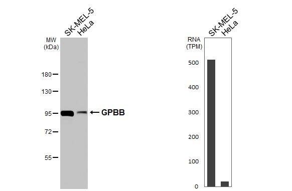 Glycogen Phosphorylase BB/GPBB Antibody