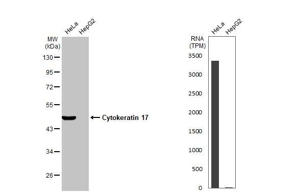 Cytokeratin 17 Antibody - BSA Free