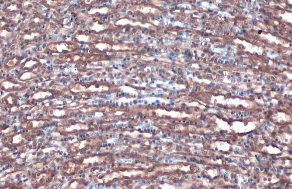 Villin 1 Antibody