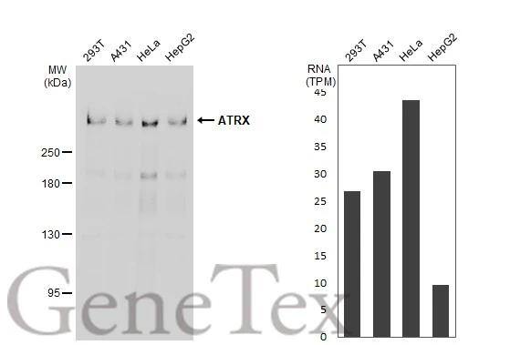 ATRX Antibody