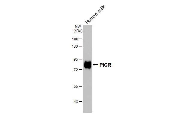 pIgR Antibody