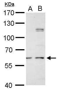 N-Acetylgalactosamine-6-Sulfatase/GALNS Antibody - BSA Free