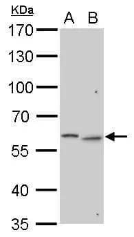 N-Acetylgalactosamine-6-Sulfatase/GALNS Antibody - BSA Free