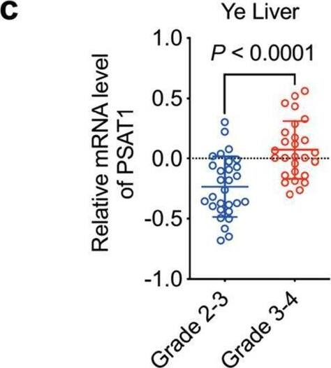 PSAT1 Antibody