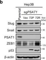 PSAT1 Antibody