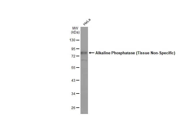 Alkaline Phosphatase, Tissue Non-Specific Antibody