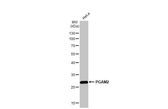 PGAM2 Antibody
