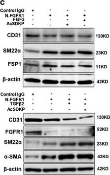 Transgelin/TAGLN/SM22 alpha Antibody - BSA Free