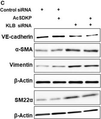 Transgelin/TAGLN/SM22 alpha Antibody - BSA Free