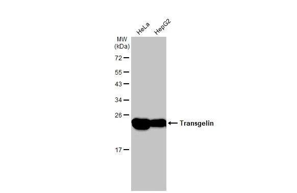 Transgelin/TAGLN/SM22 alpha Antibody - BSA Free